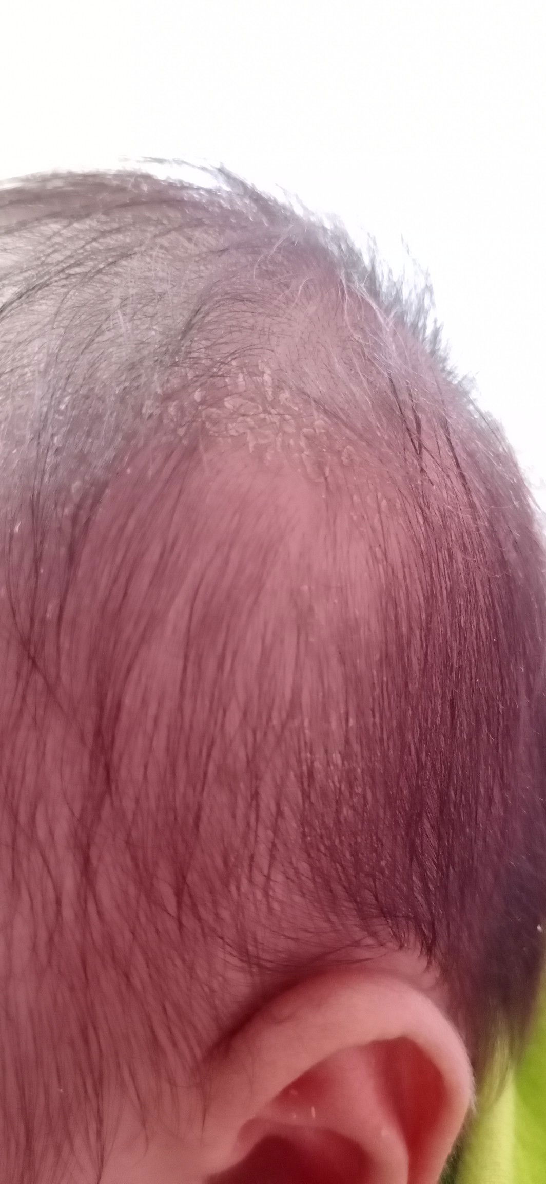 cara bersihkan kili kili pada baby