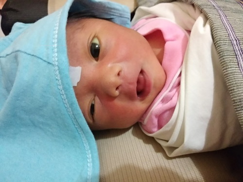 mata kuning