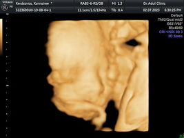 Sathapanaphong Kerdsolos profile icon