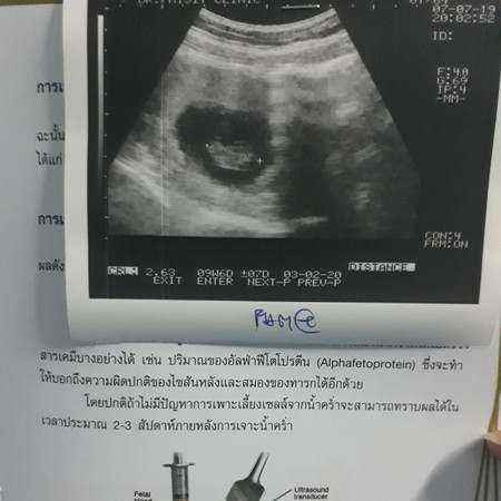 ไม่ได้กินยาบำรุงเลือด