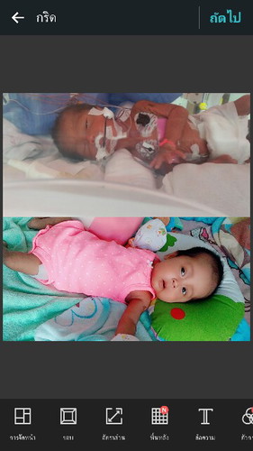 คลอดก่อนกำหนด