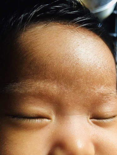 Tiny white watery spots