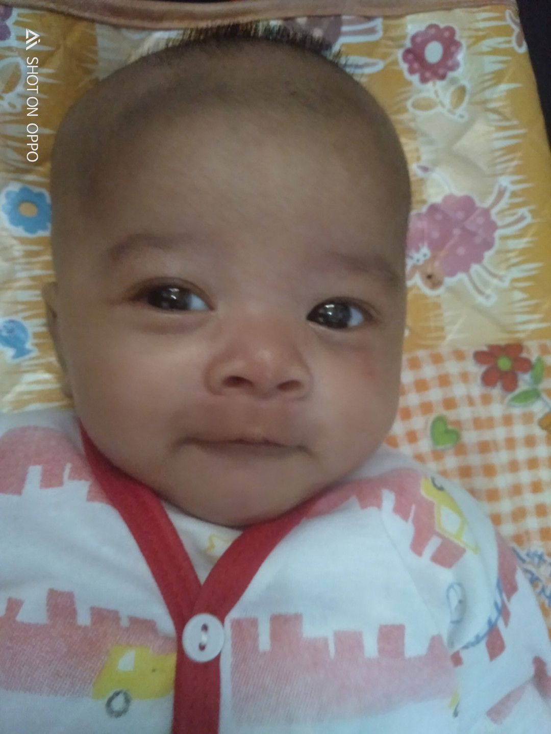 cara menumbuhkan rambut bayi