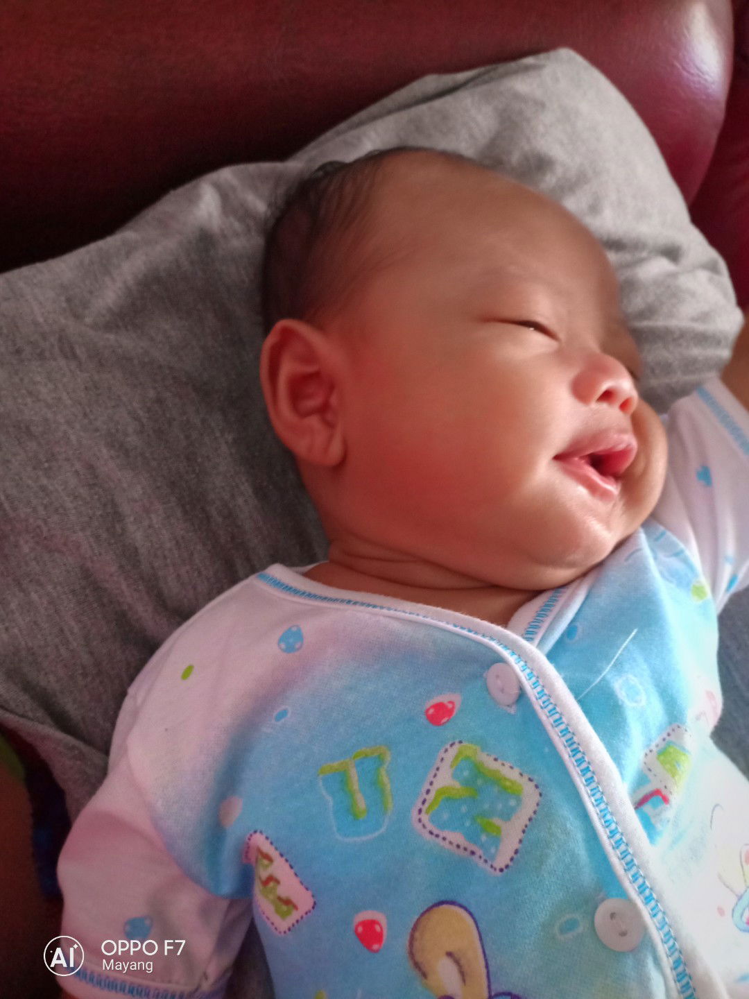 leher baby merah dan lembab