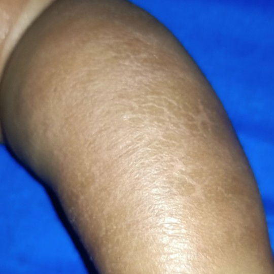 masalah kulit pada bayi