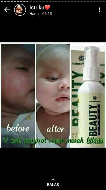 SOLUSI UNTUK MASALAH IBU