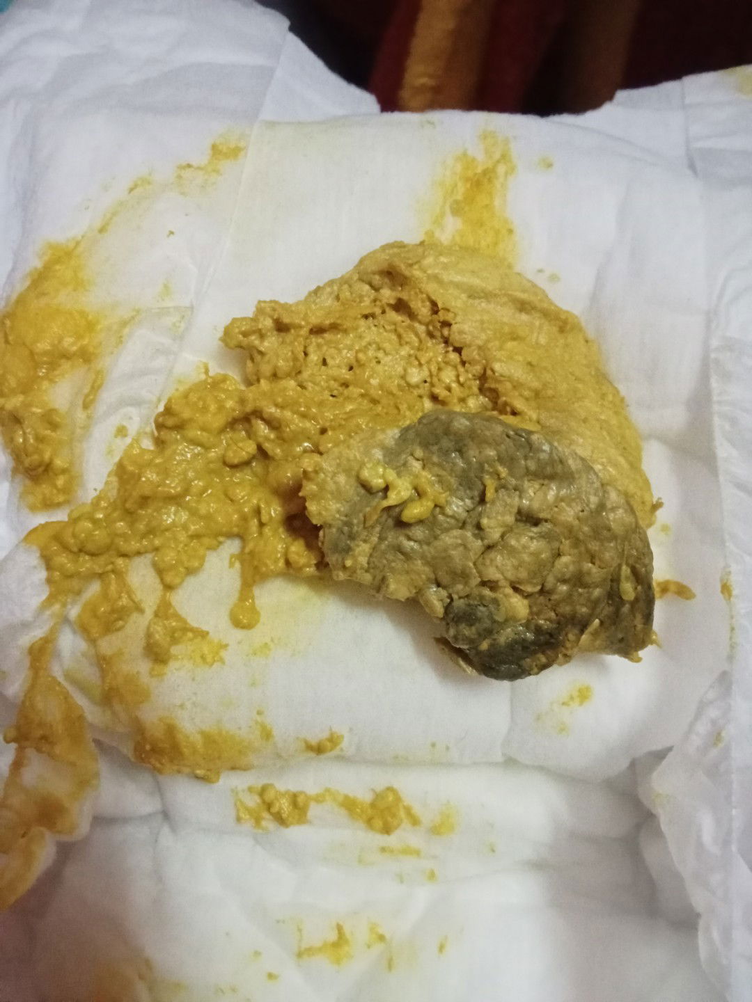 อึแบบนี้ผิดปกติหรืออันตรายไหมคะ