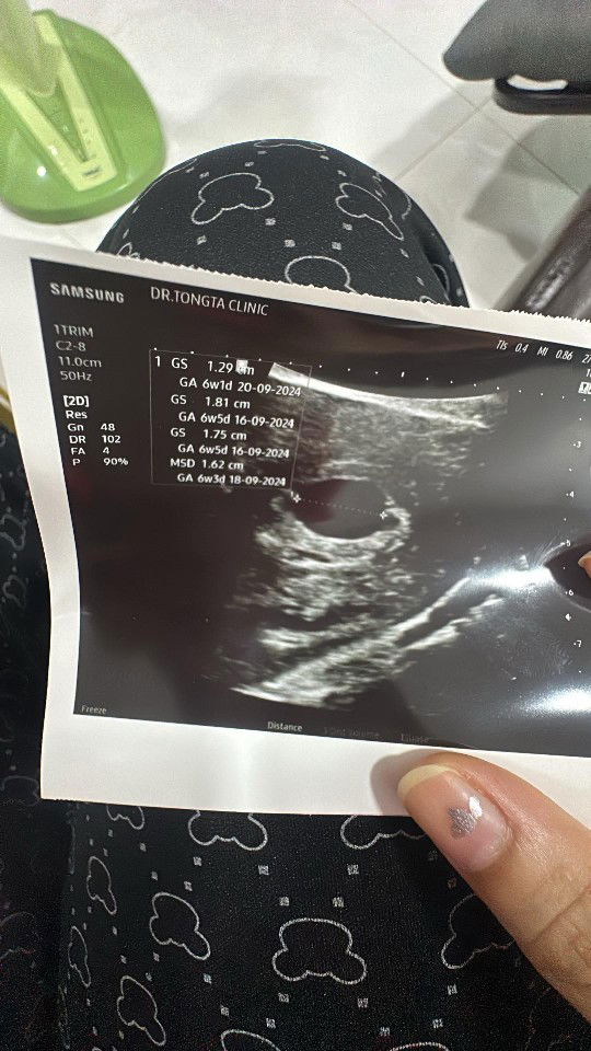 คุณเเม่มือใหม่