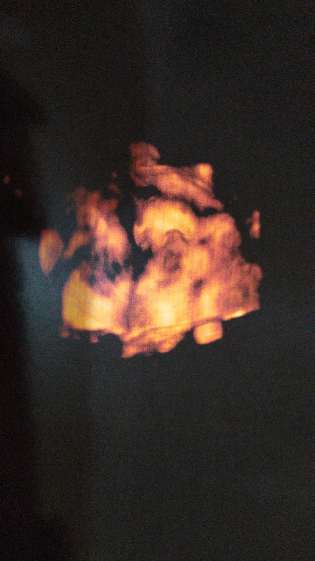 usia kandungan dan bb baby 38 weeks