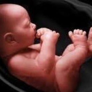 Ulpi Miftahul Zannah profile icon