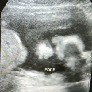 Aixee Selibaca profile icon