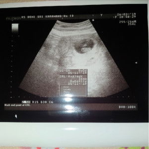 Ika Hartono profile icon