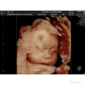 Irlin Marcelina profile icon