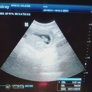 Eva Maya Sari profile icon