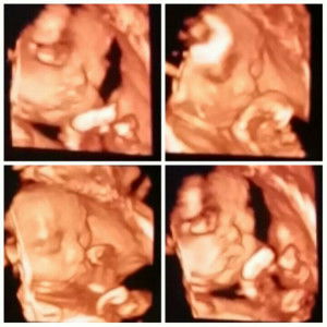 Devhi M S profile icon