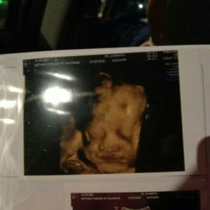 Septiana Tunggal profile icon