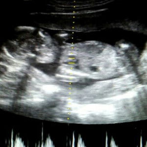 soon to be mommy! profile icon