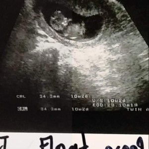 เด๊ะ พิ้ง profile icon