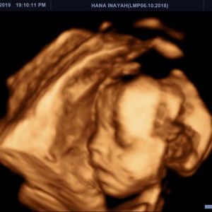 Hana Tintin profile icon