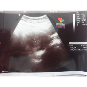 Jathu Ruumasha Dee Fitri profile icon