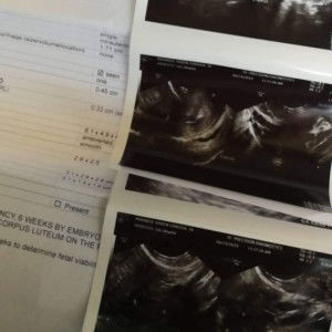 Kaye Miranda profile icon