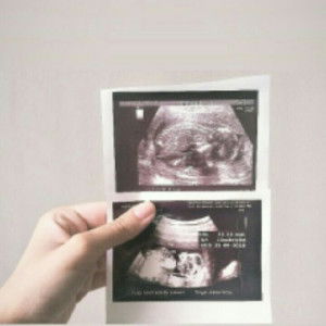 leolloyd profile icon