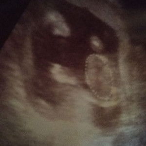 tri surahmi profile icon