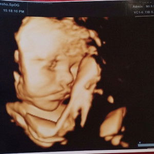 Adinda Zahra Mentarie Prasetyo profile icon