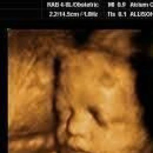 Ummu Azkha profile icon