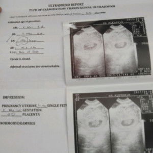 Sette Tayco profile icon