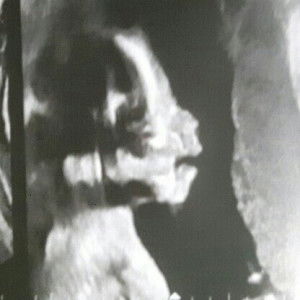 evankyerix profile icon