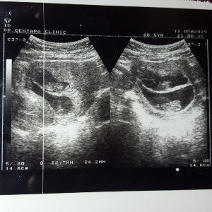 คุณแม่ลูกแฝด profile icon