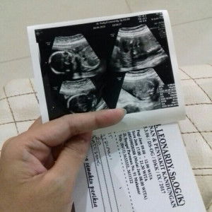 Fitriani Nurdin profile icon