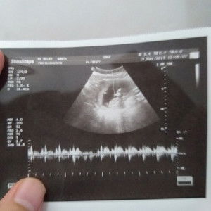 (Jelly)Jelita Adelia profile icon