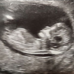 Touching profile icon