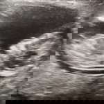 Touching profile icon