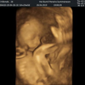 Nurul hikmah profile icon