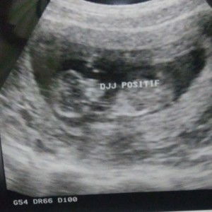 Upik Nilam Sari profile icon