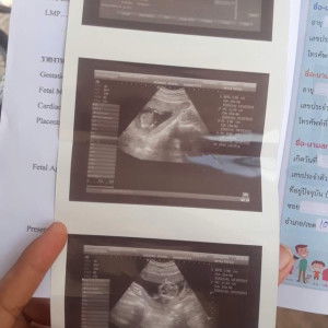 Nawaporn Phuwongsri profile icon