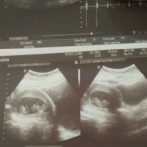 Angela Taguinod profile icon