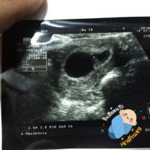 Wannisa Kusungnoen profile icon