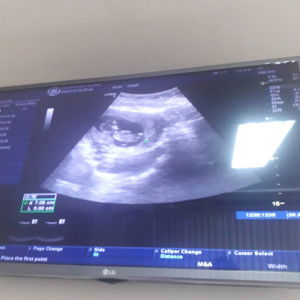 Pinyarut Ploy LekPetch profile icon