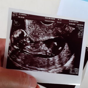 Manda Pradesian profile icon