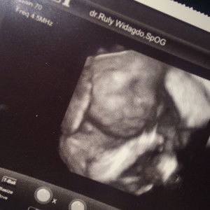 Irma Suryani profile icon