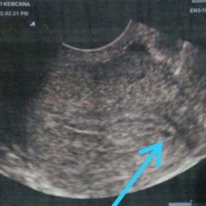 Advia Ahmad profile icon