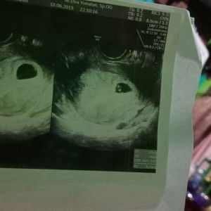 Dina Destyana profile icon