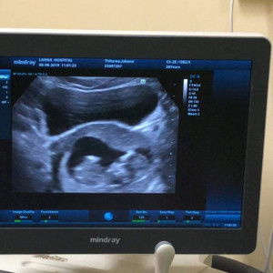 THTR OO profile icon