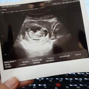 Refi Cintya profile icon