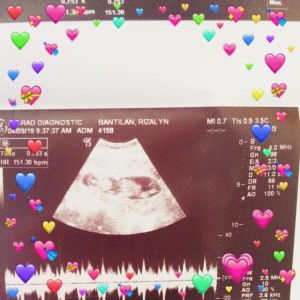 YEn YEn profile icon