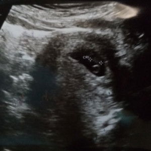 Soedvipa profile icon